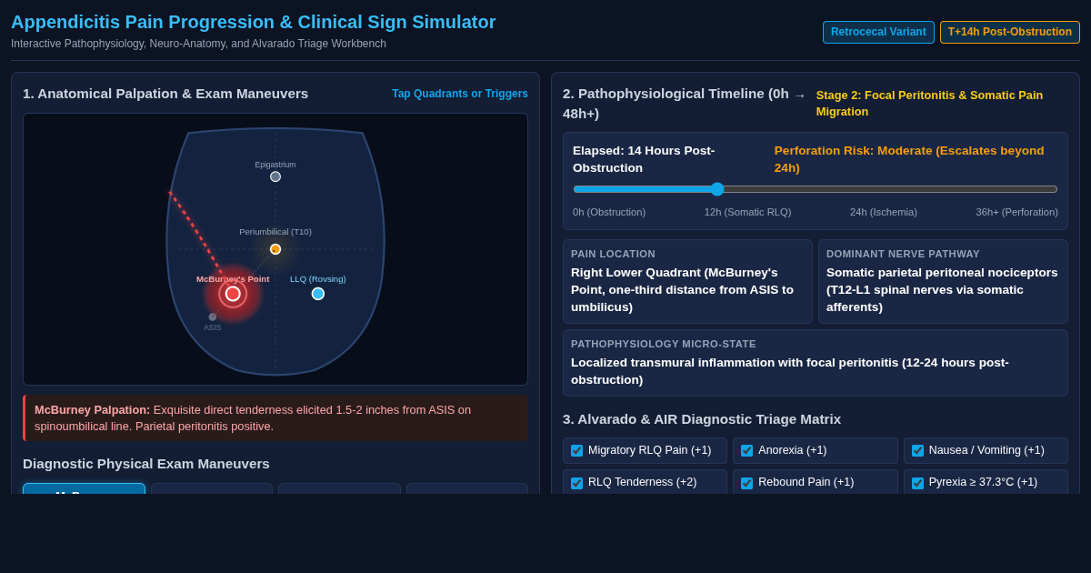 Appendicitis Pain Progression & Clinical Sign Simulator preview