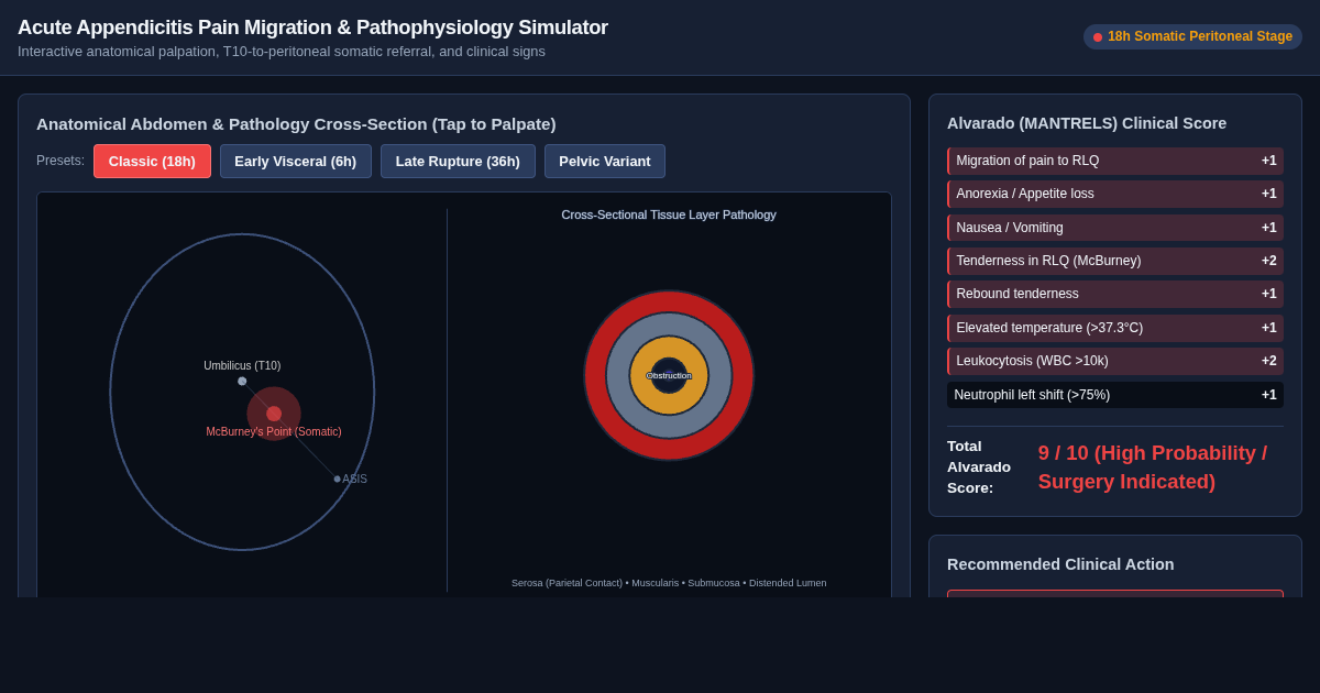 Appendicitis Pain Migration & Clinical Simulator preview