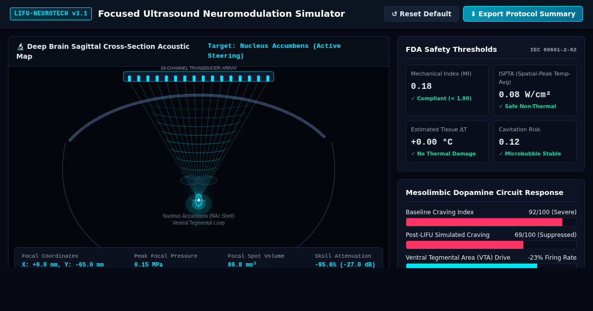 Focused Ultrasound Neuromodulation Simulator | LIFU Deep Brain Targeting preview
