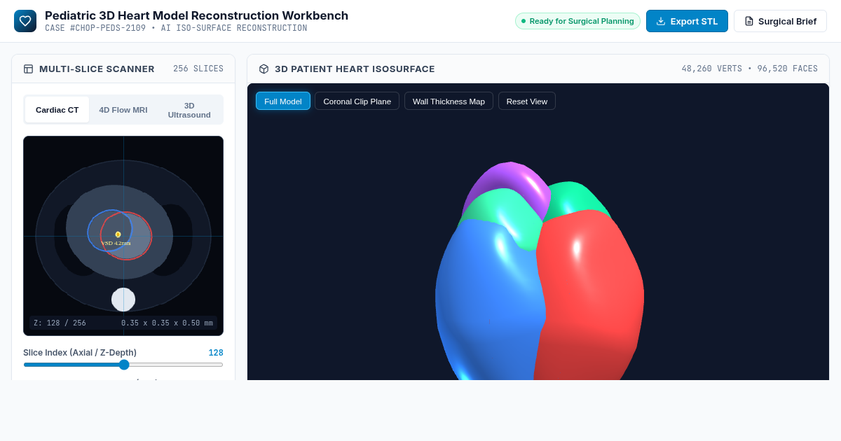 Pediatric 3D Heart Model Reconstruction Workbench preview