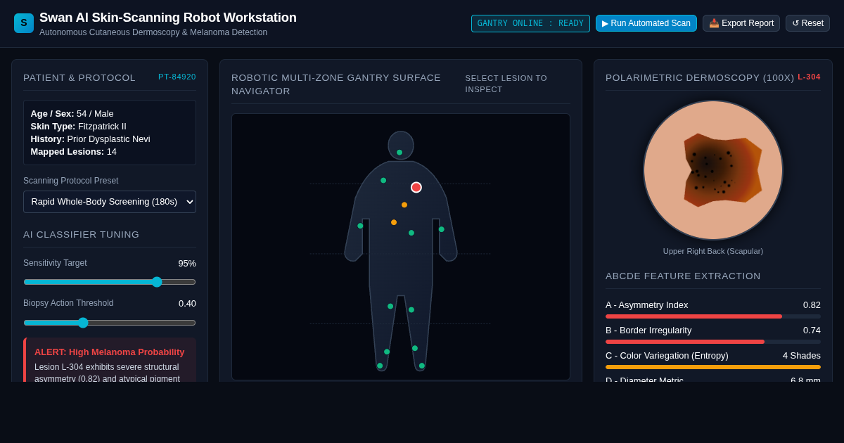 Swan AI Robotic Skin Scanner & Melanoma Triage Workstation preview