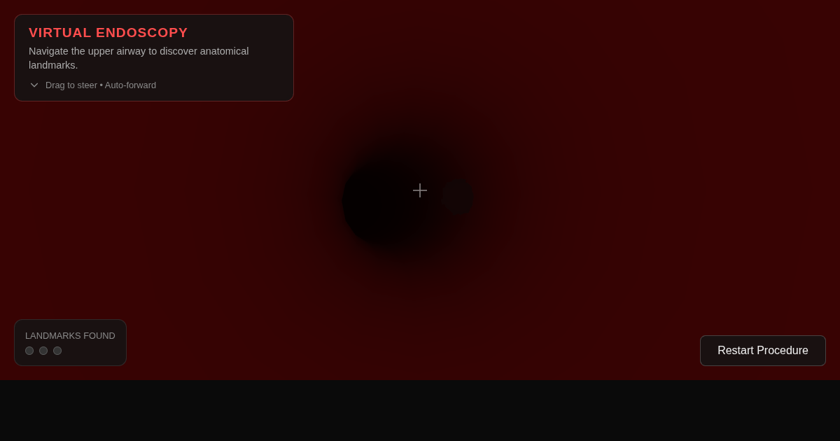 Virtual Endoscopy Explorer preview